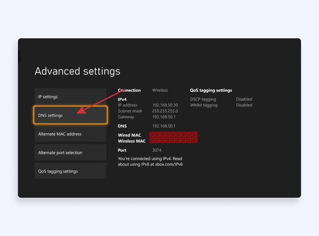 Advanced settings Xbox console